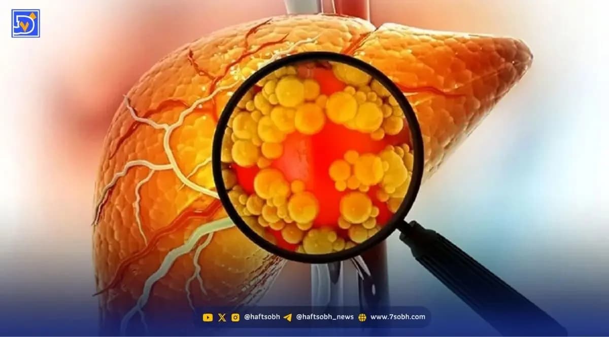 اگر نمی خواهید کبدتان چرب شود بخوانید
