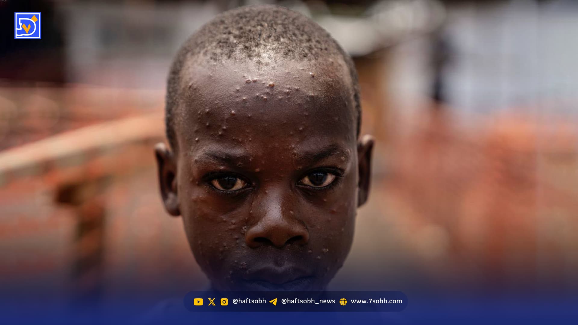 جهانی‌ بی‌پناه‌تر | مرگ اضافی بیش از ۷۵۰‌هزار نفر در جهان