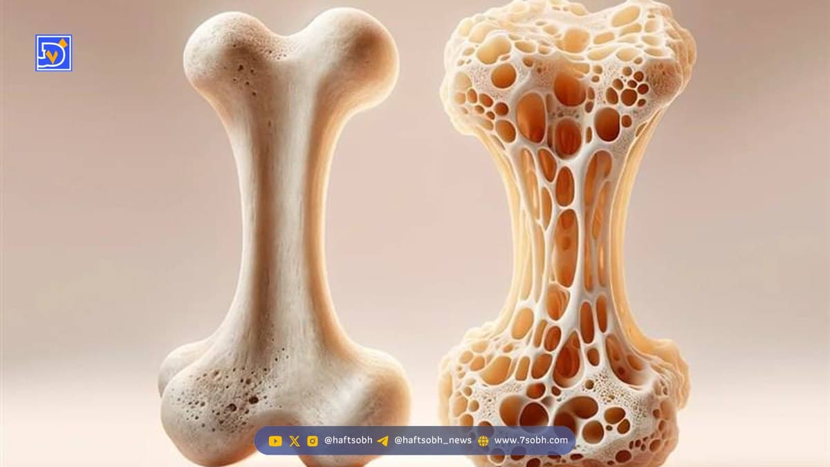 فولادی شدن استخوان ها با یک فنجان ساده از این نوشیدنی