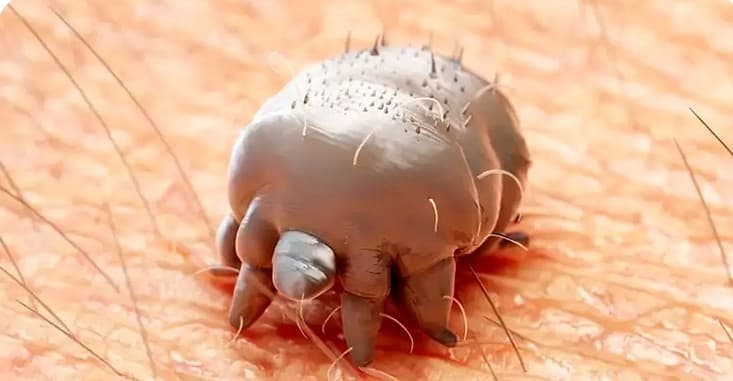 بهترین پماد و آمپول برای بیماری گال