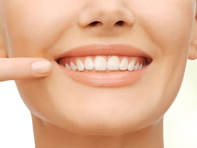 این ۵ مورد قاتل دندان‌های شما هستند