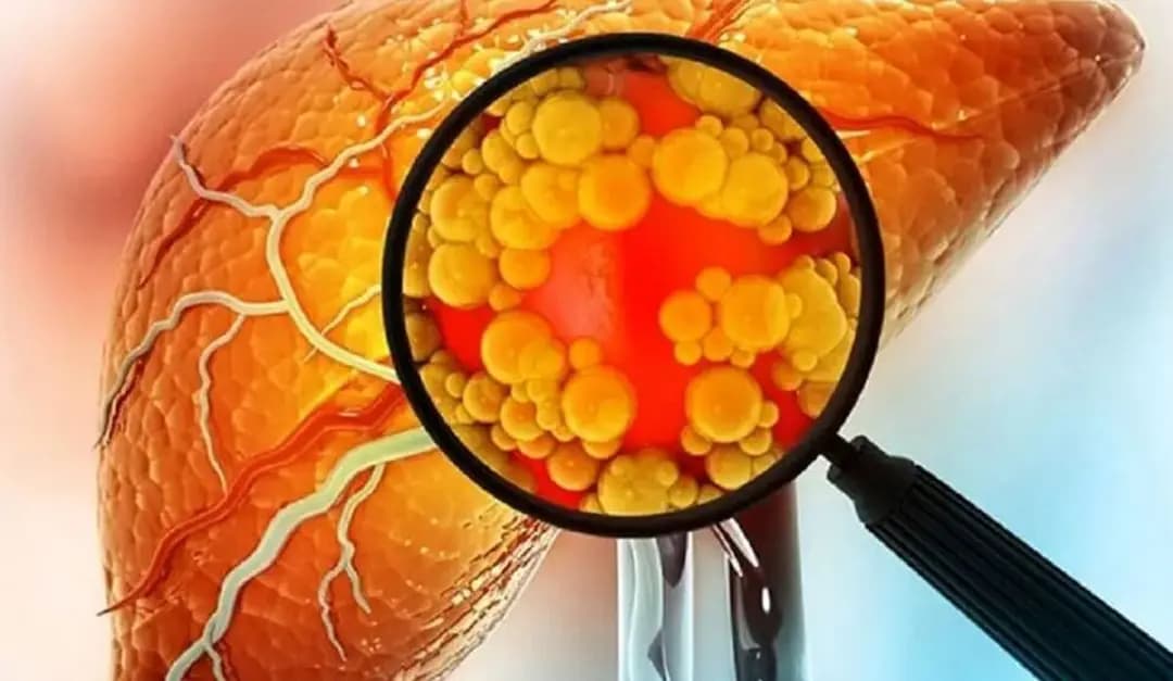 اگر می خواهید کبدتان همیشه سالم بماند این موارد را رعایت کنید