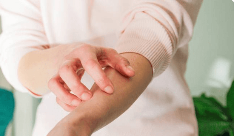 بهترین دارو برای خارش بدن خانگی