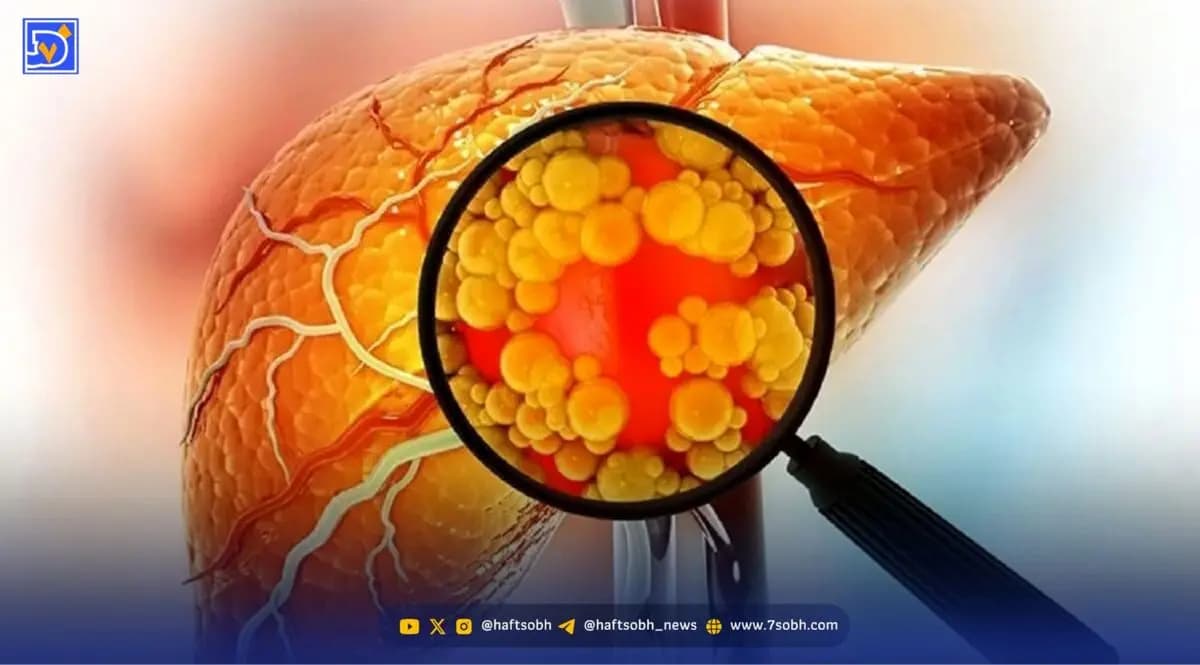 راه درمان کبد چرب مشخص شد؛ معجزه می‌کند!