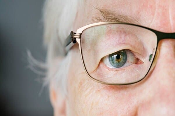 پیرچشمی چیست و چه زمانی بروز میکند؟