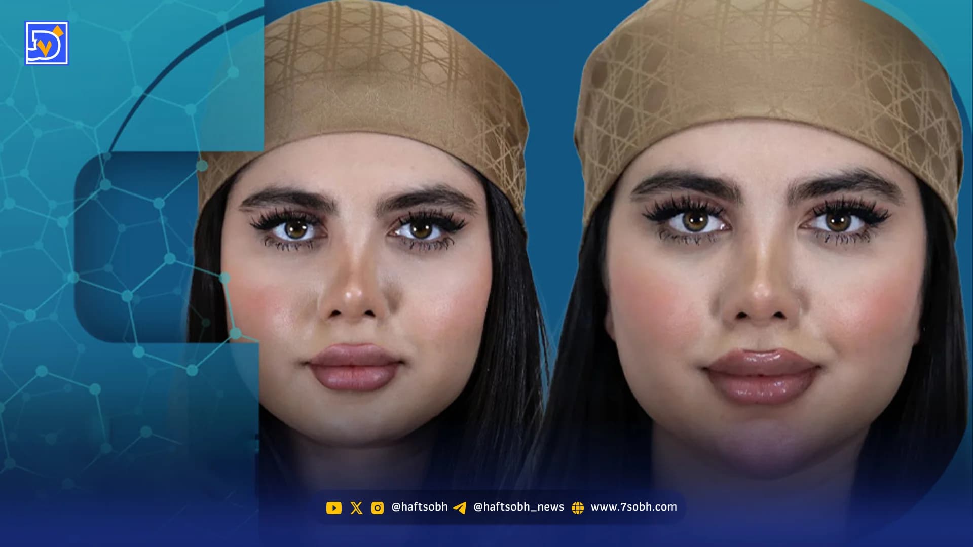 ژل صورت تزریق کنیم یا نه؟