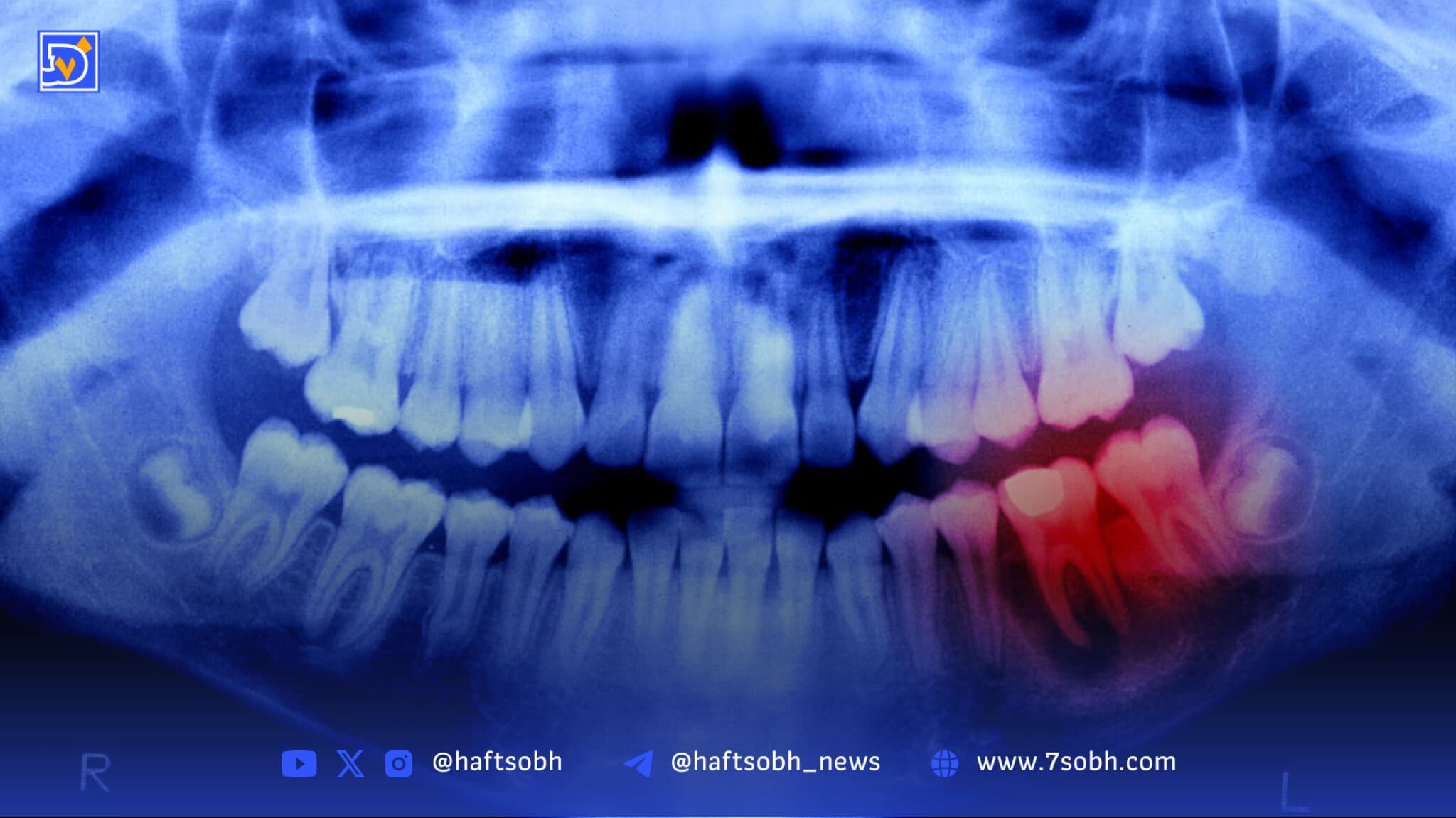 انسانها تا ۴ سال آینده میتوانند دندانهای جدید رشد دهند