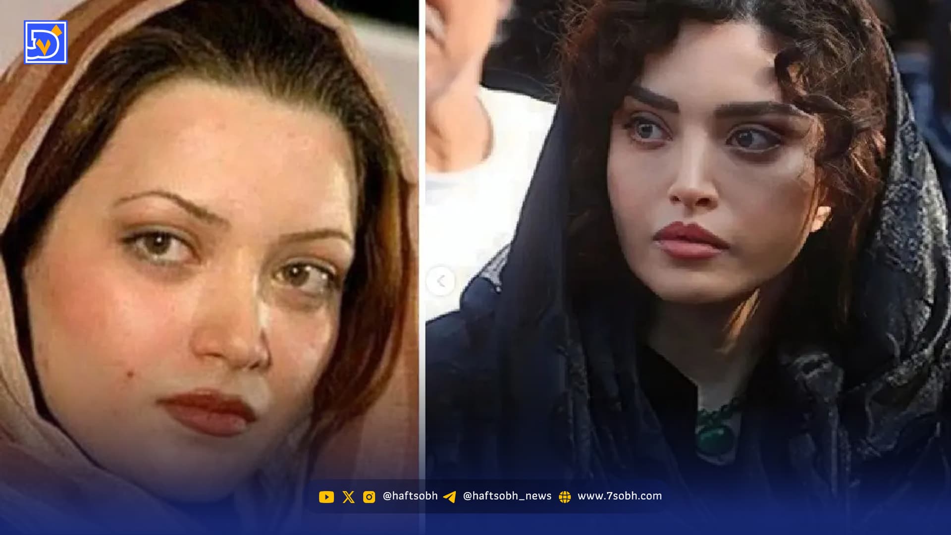 تصاویر دیده نشده از بازیگران ایرانی قبل از عمل های زیبایی/ از امین حیایی تا طناز طباطبایی و سحر دولتشاهی