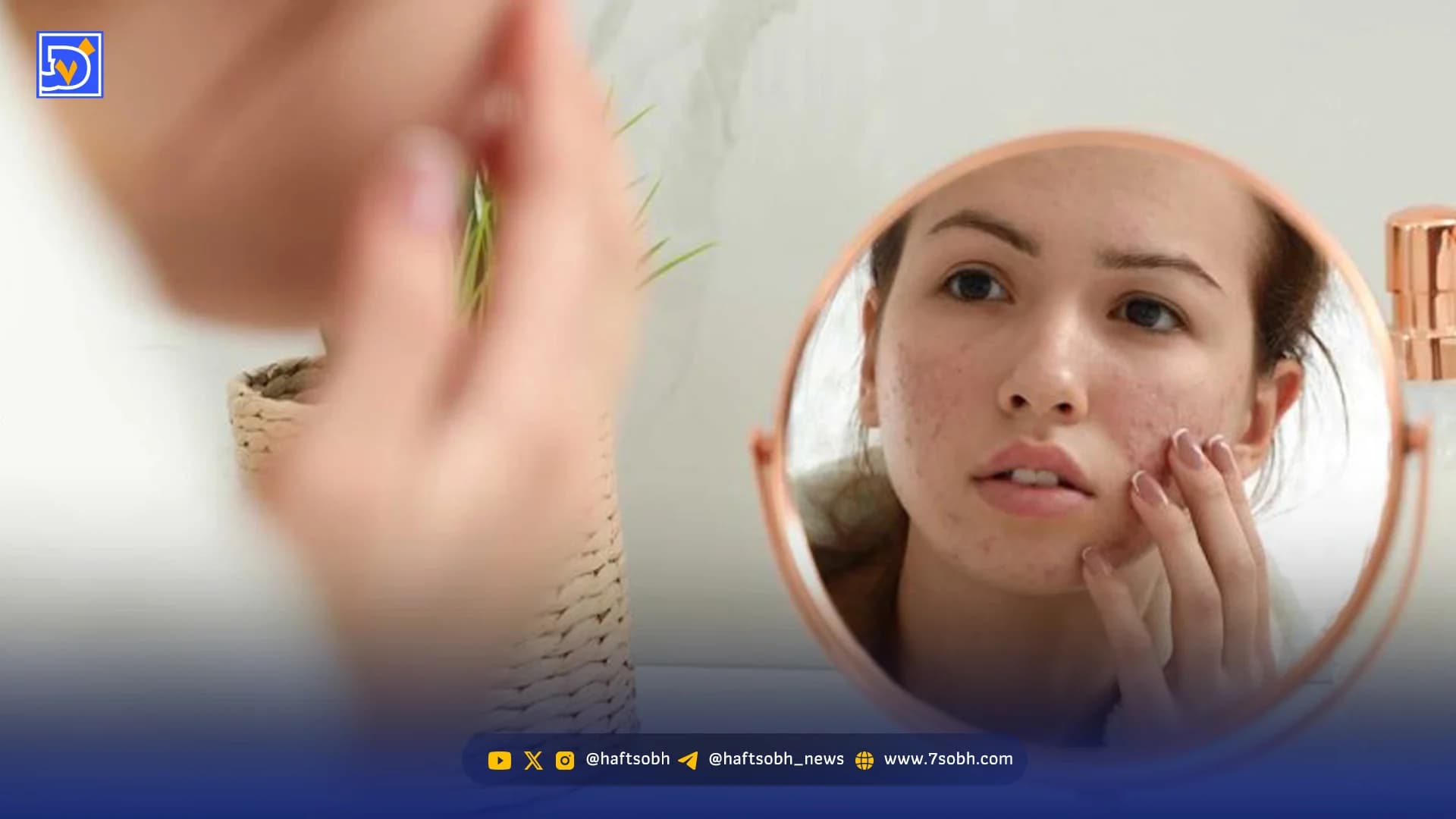 افزایش مشکلات پوستی در روزهای بحران